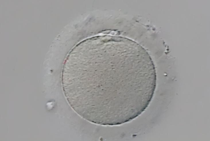 胚胎受精解读：2PN、0PN、1PN有什区别？