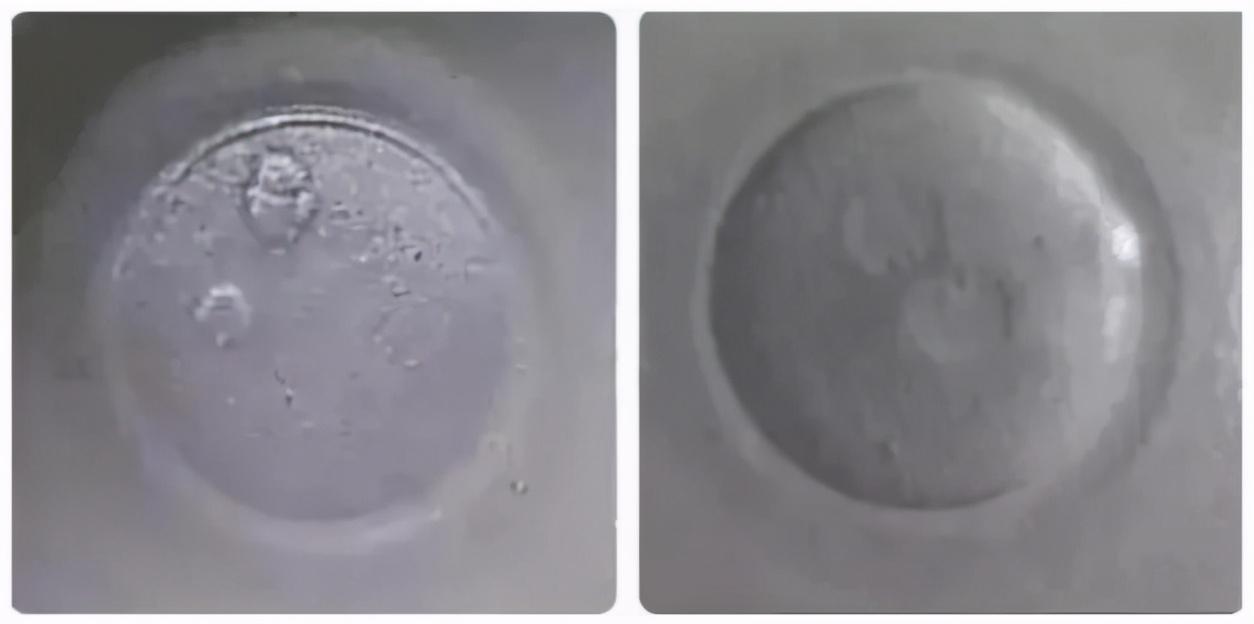 胚胎受精解读：2PN、0PN、1PN有什区别？