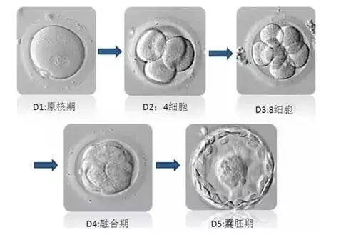 试管婴儿反复失败，警惕女性遗传缺陷