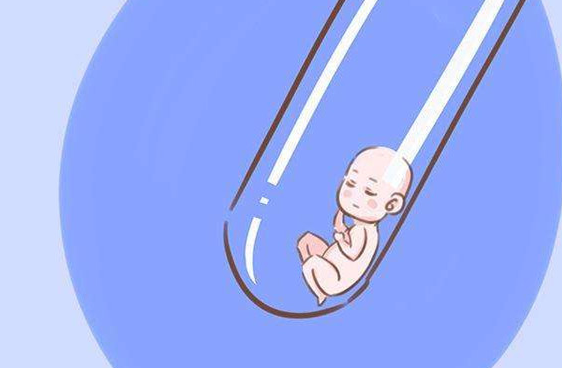 试管婴儿超长方案是什么 流程是怎么样的 