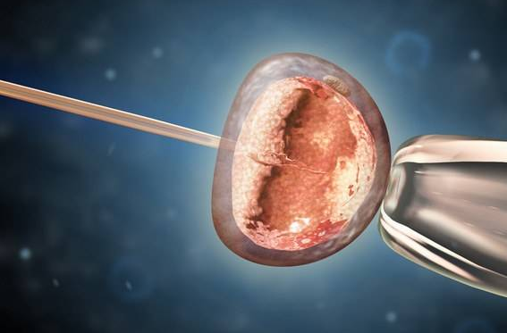 胚胎移植注意事项有哪些 饮食禁忌有哪些