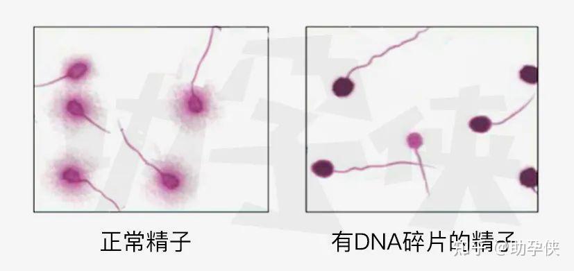 男士备孕精子碎片率到底要不要查？影响有多大？